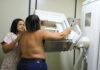 Carreta de Mamografia oferece 700 exames gratuitos para mulheres atendidas pelo SUS; saiba como agendar